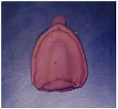Activated Zinc Oxide