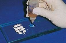 Zinc Phosphate